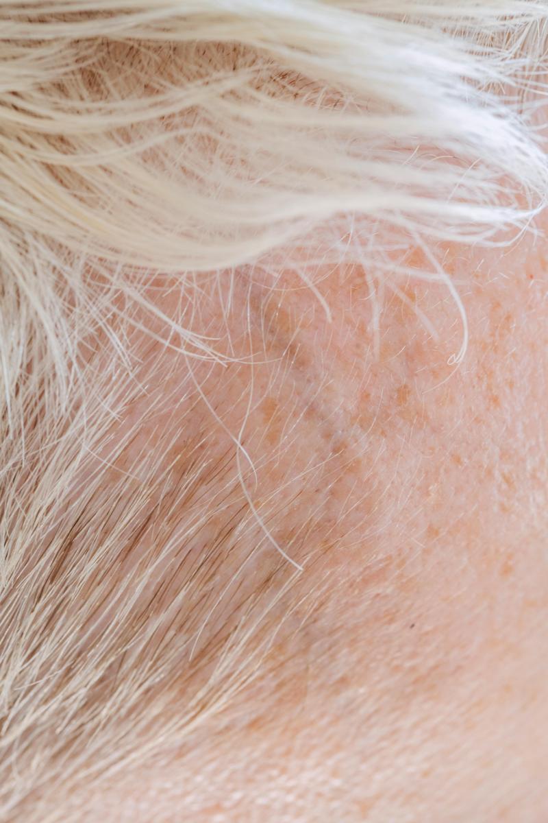 Hair strands