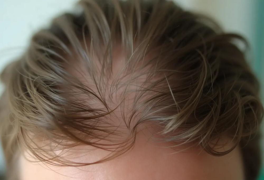 Healthy hair